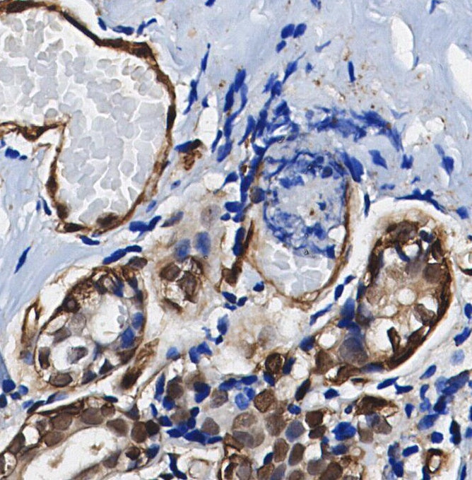 p70 S6 Kinase Antibody
