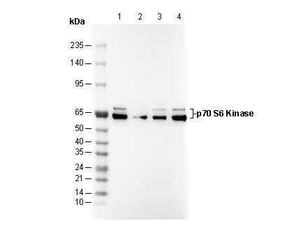 p70 S6 Kinase Antibody