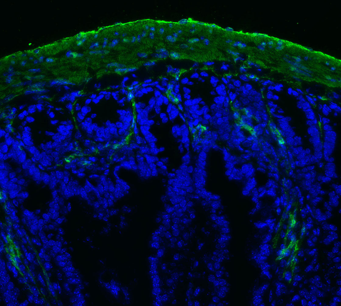 α-Smooth Muscle Actin Antibody