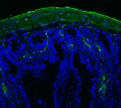 α-Smooth Muscle Actin Antibody