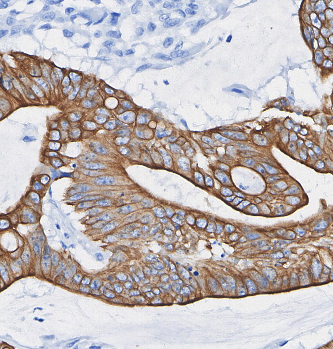 APP A4 Antibody