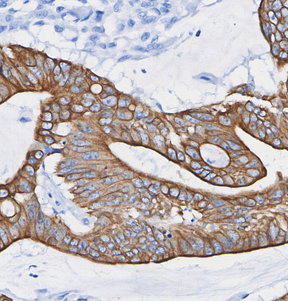 APP A4 Antibody