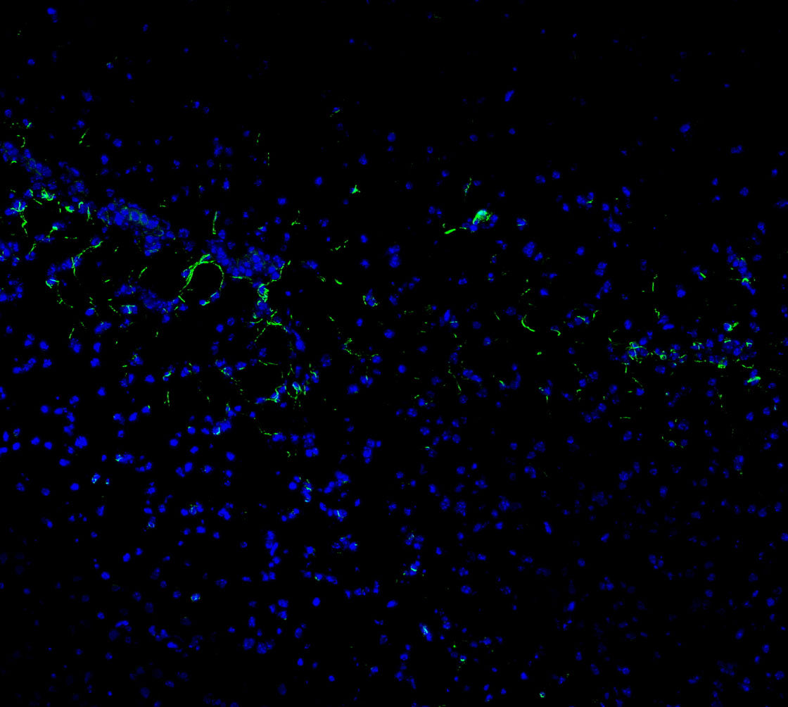 Nestin Antibody