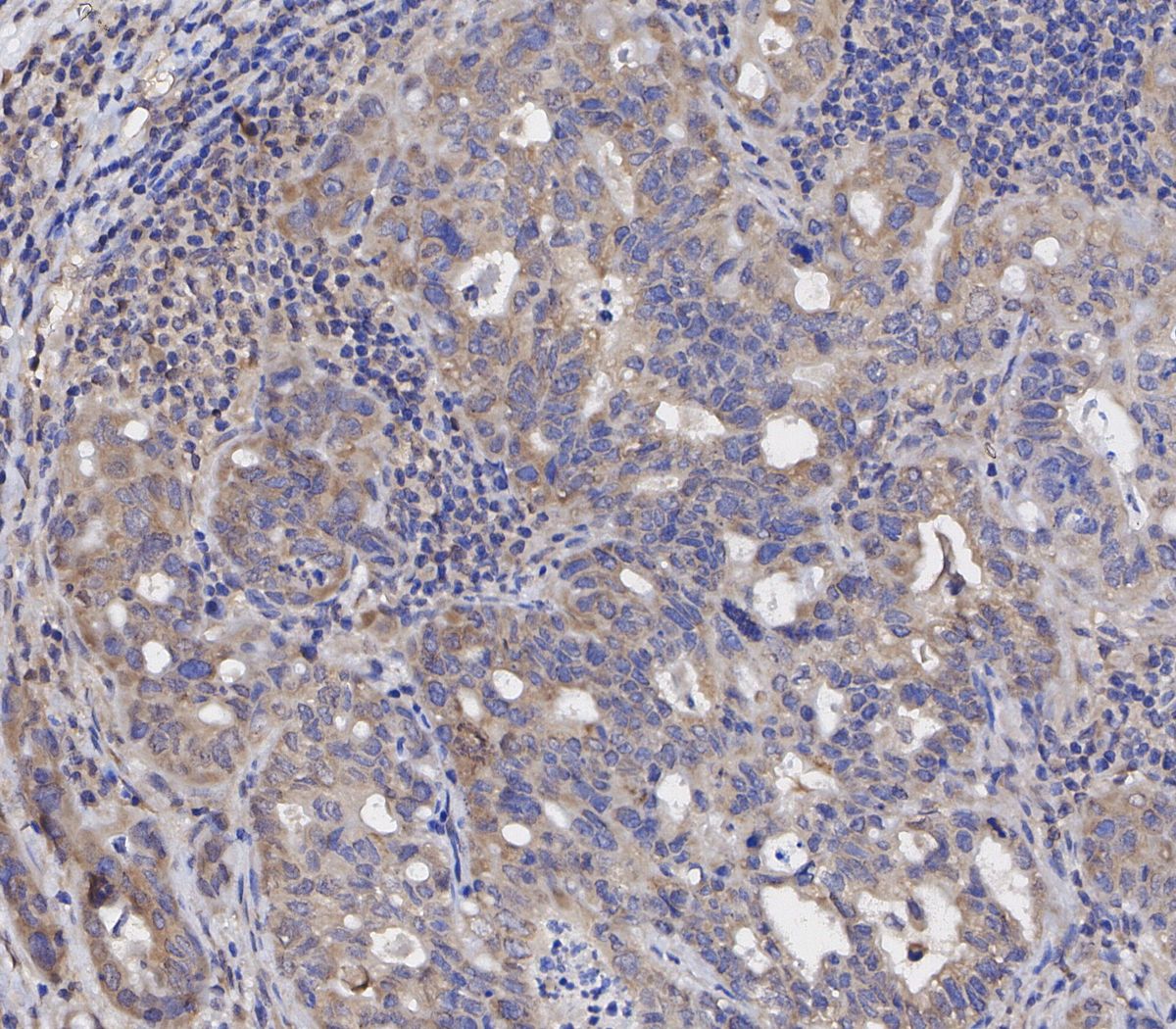 Bax Antibody