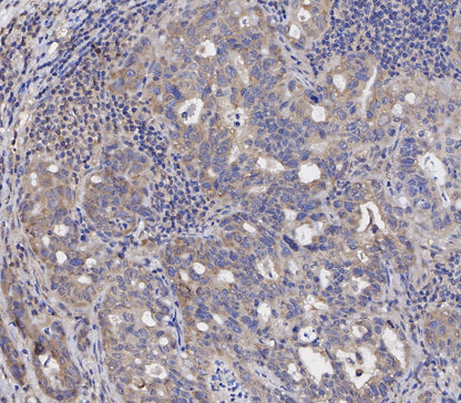 Bax Antibody