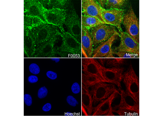 EGF Receptor Antibody