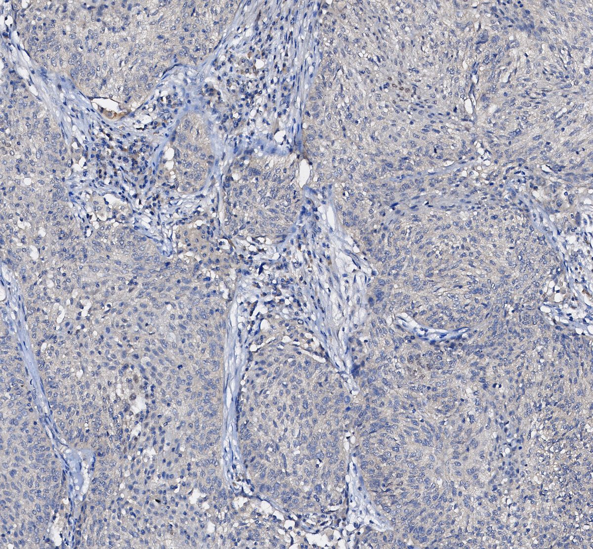 EGF Receptor Antibody