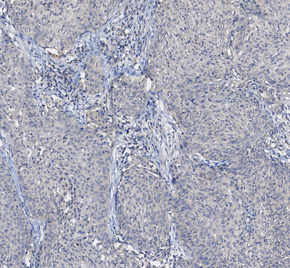 EGF Receptor Antibody