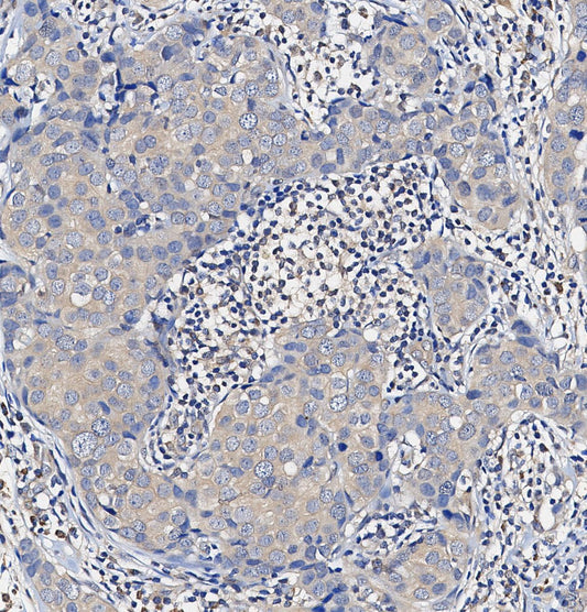 GFP Antibody