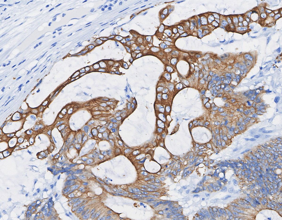 Phospho-Tau (Ser202/Thr205) Antibody