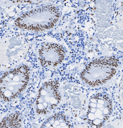 GAD67/GAD1 Antibody