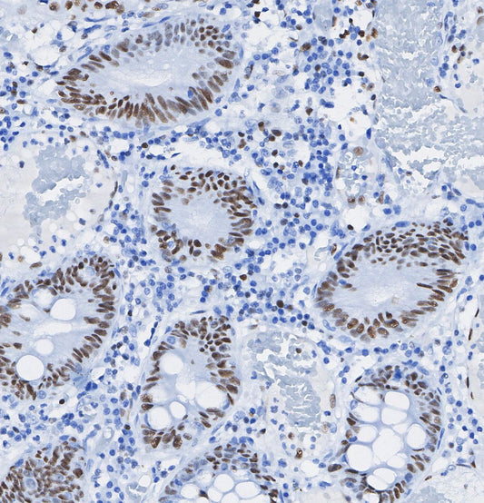 GAD67/GAD1 Antibody