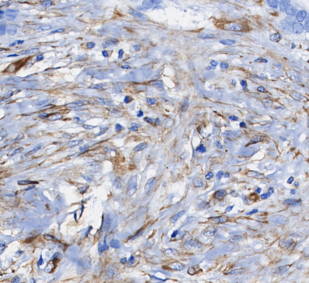 Actin Antibody