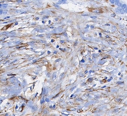 Actin Antibody