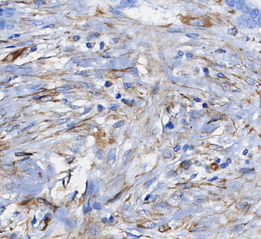 Actin Antibody