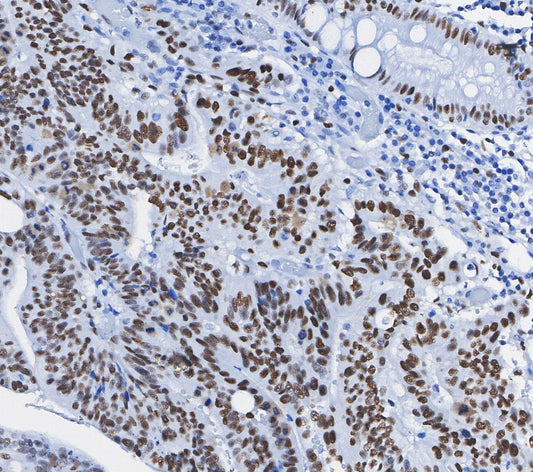 Cyclin E1 Antibody