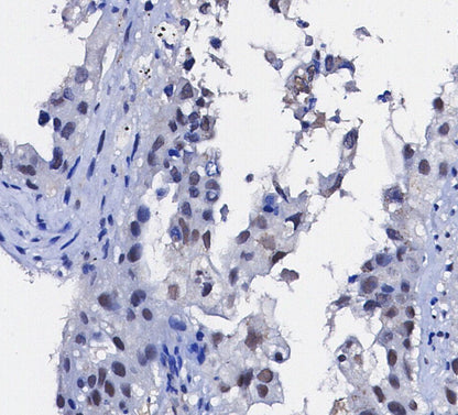 HIF-1α Antibody
