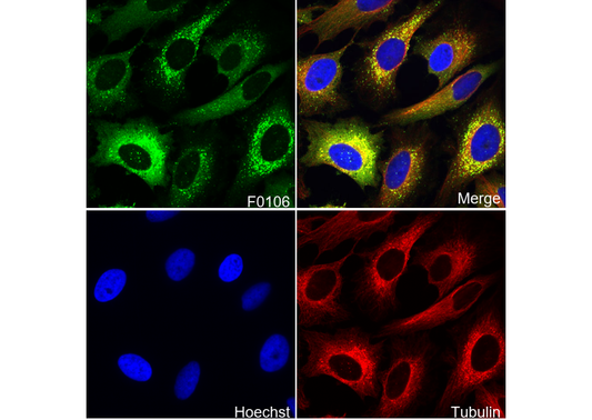 SQSTM1 / p62 Antibody