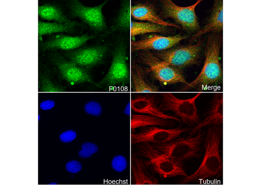 Tyrosine Hydroxylase Antibody