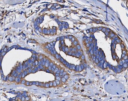 Bcl-2 Antibody