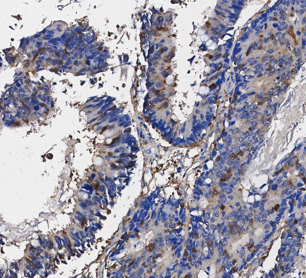 4E-BP1 Antibody