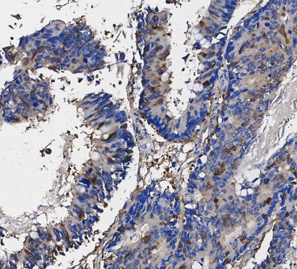 4E-BP1 Antibody