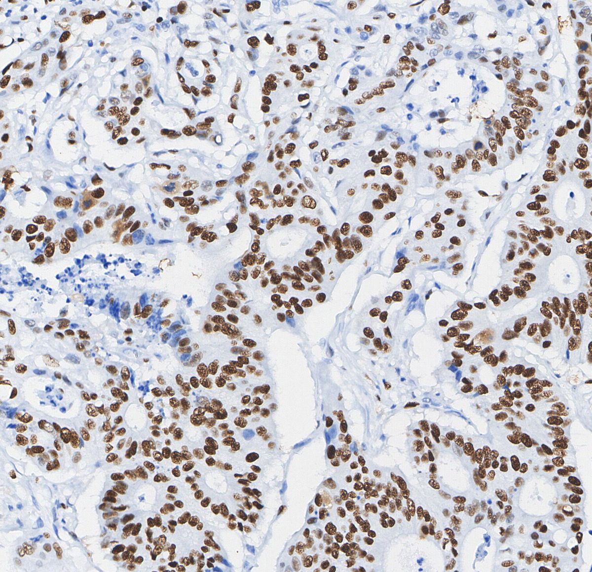 CREB Antibody
