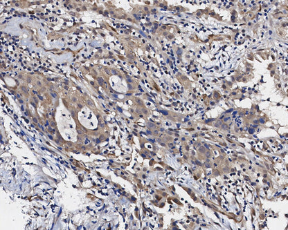 Cleaved Caspase3 (Asp175) Antibody