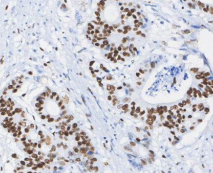 Cyclin D1 Antibody