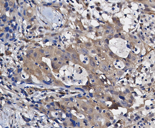 FoxO1 Antibody