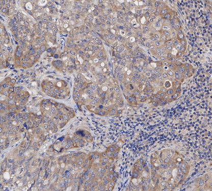 GSK-3β Antibody