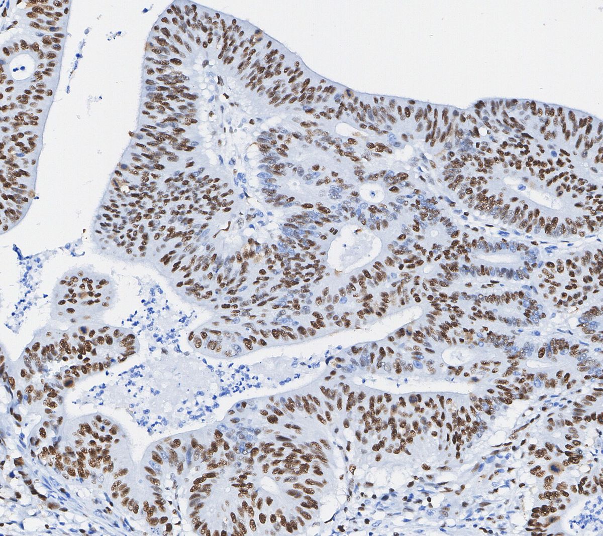 Phospho-STAT3 (Tyr705) Antibody