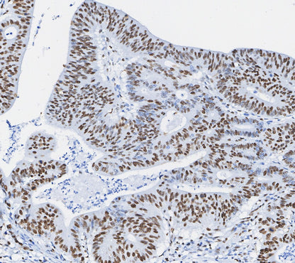 Phospho-STAT3 (Tyr705) Antibody