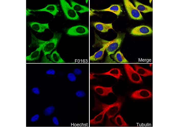 S6 Ribosomal Protein Antibody