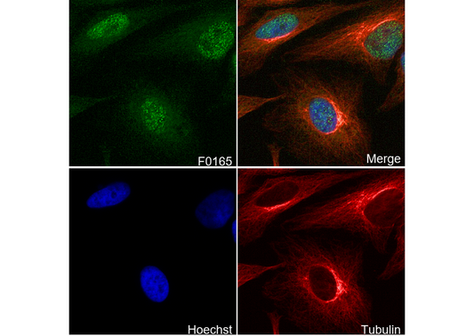 Histone H3 (tri methyl Lys27) Antibody
