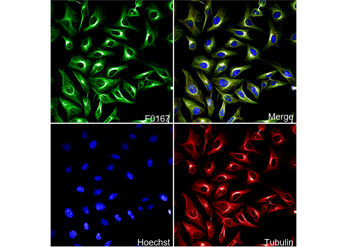 β-Tubulin Antibody