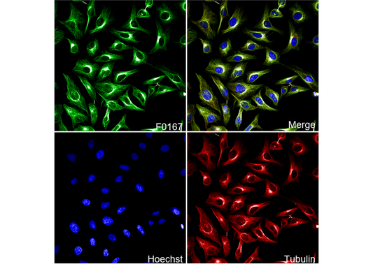 β-Tubulin Antibody