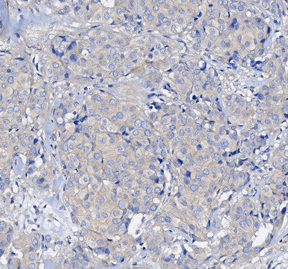 mTOR Antibody