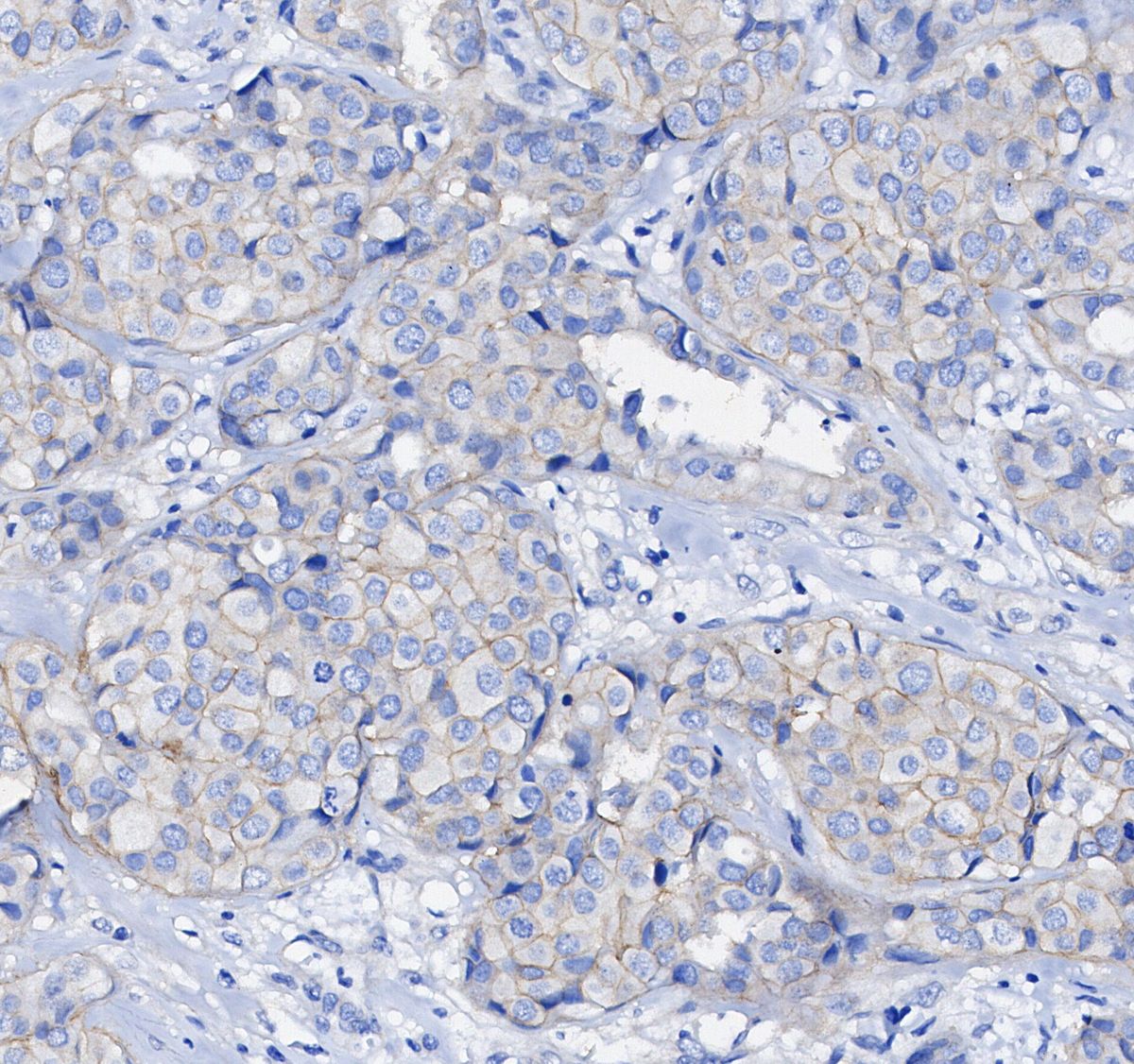 p38 MAPK Antibody