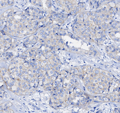 p38 MAPK Antibody