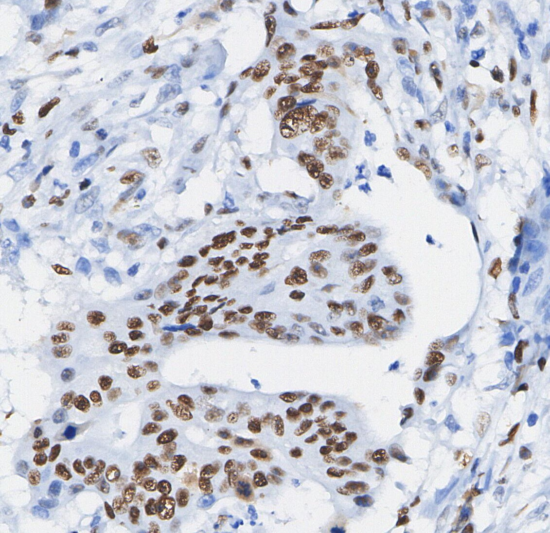Cyclin D3 Antibody