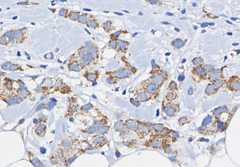 Axl Antibody