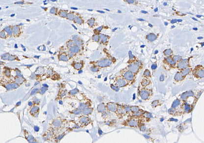 Axl Antibody