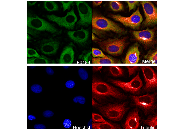 Phospho-S6 Ribosomal Protein (S235/236) Antibody