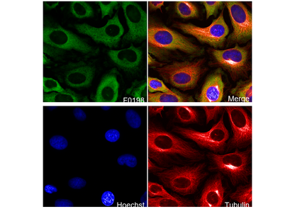 Phospho-S6 Ribosomal Protein (S235/236) Antibody