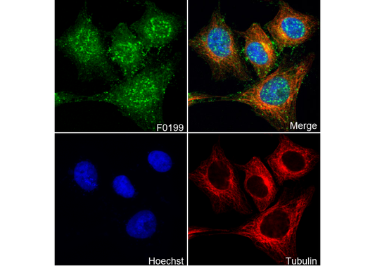 Phospho-STAT1 (Tyr701) Antibody