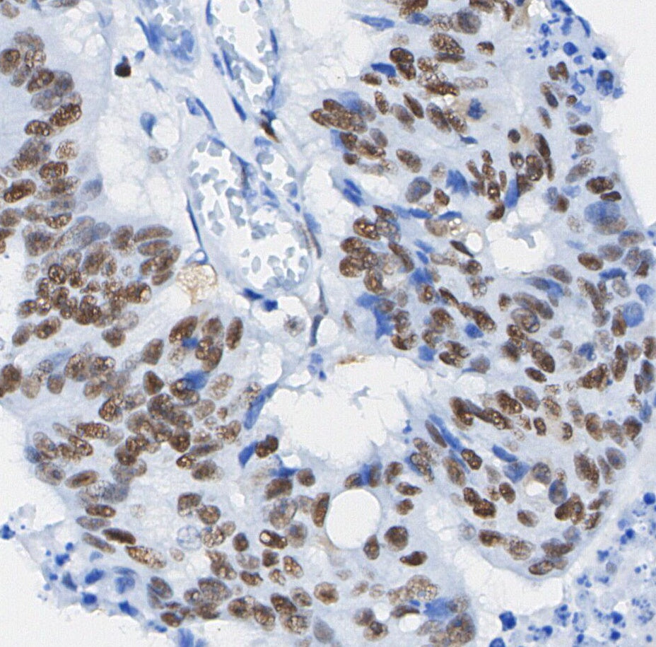 Phospho-STAT1 (Tyr701) Antibody