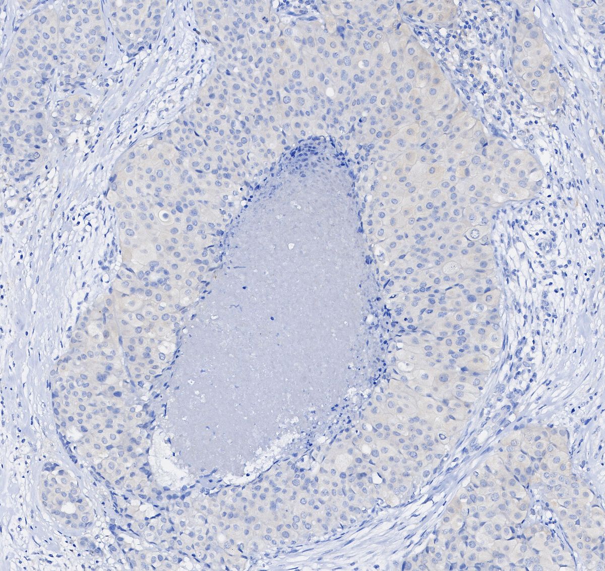Stat3 Antibody