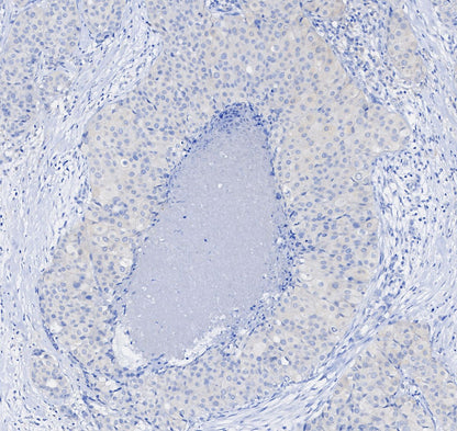 Stat3 Antibody