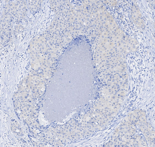 Stat3 Antibody